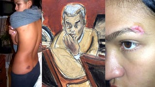 Diddy Trial: New Images of Cassie's Alleged Injuries Released