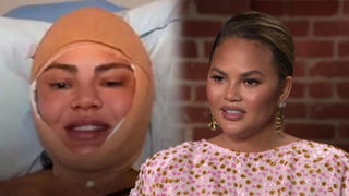 Chrissy Teigen Makes Surprising Plastic Surgery Reveal After Going Live From Hospital Bed